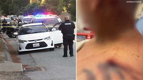 Bay Area Road Rage Victim Grateful To Be Alive After Unprovoked I 280