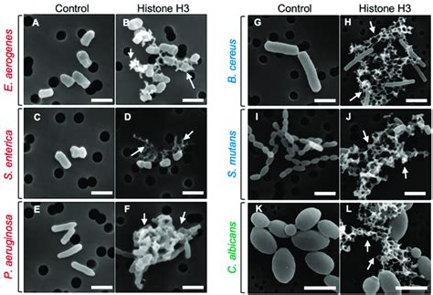 Scanning electron microscopy (SEM) images of bacterial and fungal cells ...