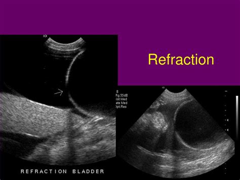 Ppt Ultrasonography Powerpoint Presentation Free Download Id623027