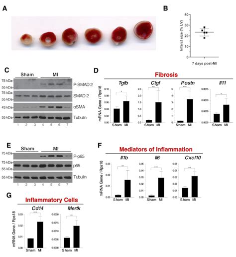 Murine Myocardial Infarction Model using Permanent Ligation of Left ...