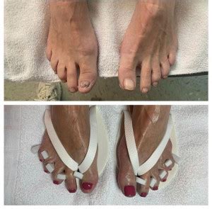 Medical Pedicures