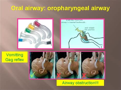 AIRWAY MANAGEMENT Jutarat Luanpholcharoenchai Topic modules Anatomy of