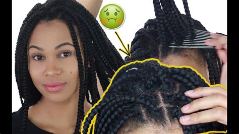 How To Clean Box Braids Remove All Dandruff And Build Up Youtube