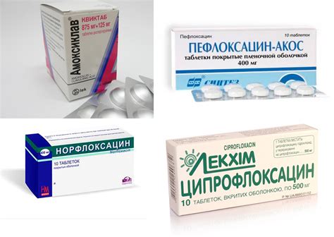 Уретрит у женщин: причины, симптомы, лечение, последствия