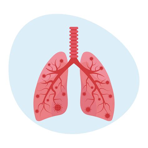 Pulmonology Billing Services | Vigilant MS