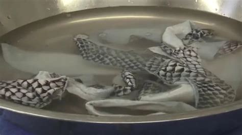 Una mujer transgénero se convirtió en la primera en recibir un implante de vagina hecho con piel