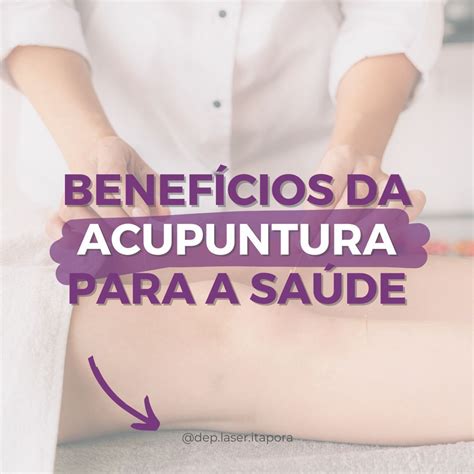 T Cnicas De Acupuntura Consistem Na Aplica O De Agulhas Finais Ou