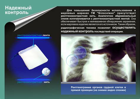Марлевые шарики с рентгеноконтрастной нитью это роскошь или ...