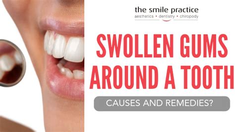 What Causes Swollen Gums And Lips Lipstutorial Org