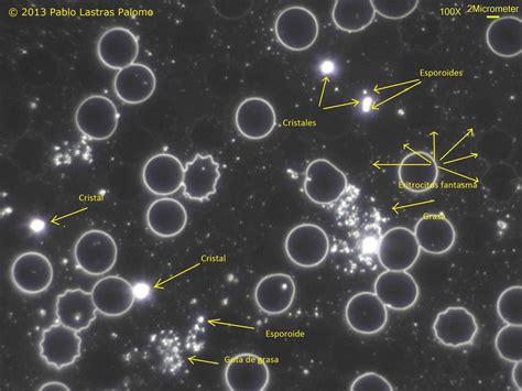 curso de campo oscuro  contraste de fase presencial cursos de