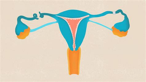 Tubal Ligation Or Permanent Female Sterilization A Misunderstood Birth