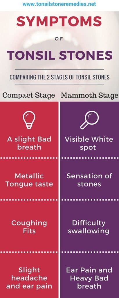 Lingual Tonsil Cancer Symptoms