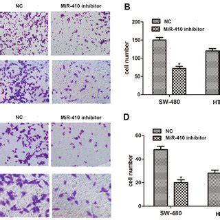 Effects Of MiR 410 On Cell Viability And Cell Apoptosis In CRC Cells