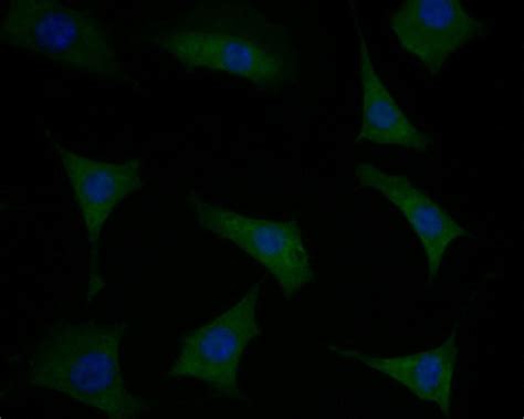 Phospholamban Polyclonal Antibody Pa5 119803