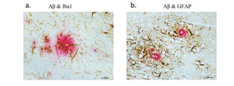 Glial Activation In Relation To Aβ Plaques In The Hippocampus Of A 12