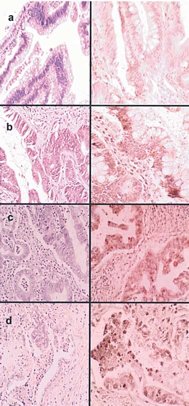 Expression Of Sox2 In Several Components Of Ampulla Of Vater Download Scientific Diagram