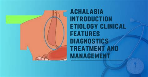 Achalasia Definition Etiology Clinical Features Diagnosis Treatments