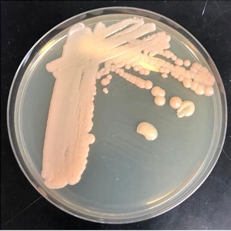 Cryptococcus Culture