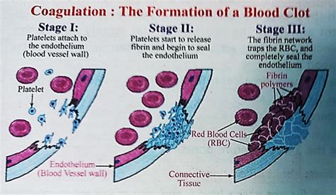 Mechanism Of Blood Coagulation Lifesciencedirect