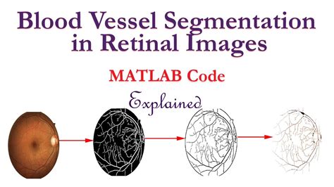 Blood Vessel Segmentation In Retinal Images Using MATLAB YouTube