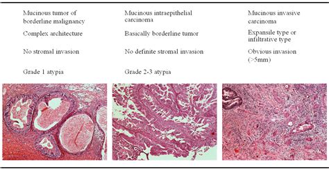 Implication Of Clear Cell And Mucinous Histology Intechopen