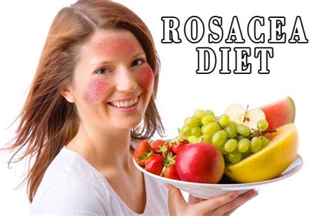 What To Avoid In Your Diet When You Have Rosacea Nikihow