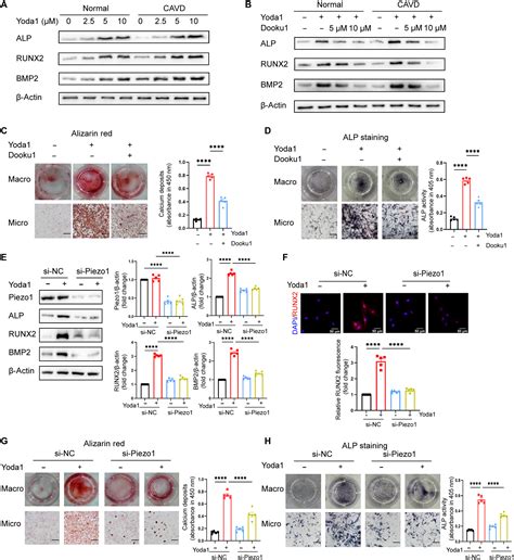 Activation Of Piezo1 Promotes Osteogenic Differentiation Of Aortic