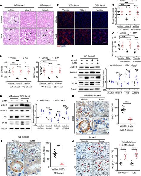 Jci Insight Aldehyde Dehydrogenase Protects Against Acute Kidney