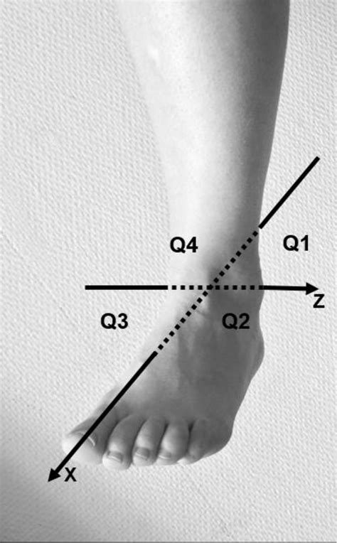 Figure 1 From Active Ankle Circumduction To Identify Mobility Deficits