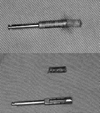 Bone biopsy samples. | Download Scientific Diagram