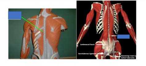 Lab 22 Muscles Of The Deep Back Abdominal Wall And Pelvic Outlet