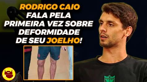 Rodrigo Caio Fala Pela Vez Sobre Foto De Joelho Inchado Que Viralizou