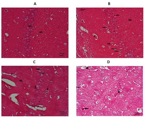 Photomicrograph of granular and molecular layers of the CA1 region of ...