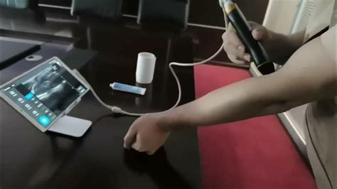 Healson C30 Linear Color Dppler Handheld Scanner - YouTube