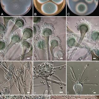 Neosartorya Fischeri A B Colonies D C A Oa B Mea C