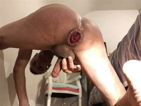 Anal Dilation Photo Shoot Pics XHamster