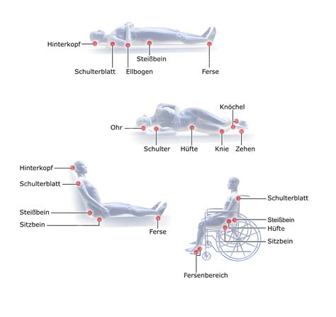 Illustration Lagerung zur Vermeidung von Dekubitus - MedicalGraphics