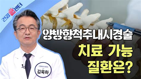 건강콜센터 양방향척추내시경술 치료 가능 질환은 YouTube