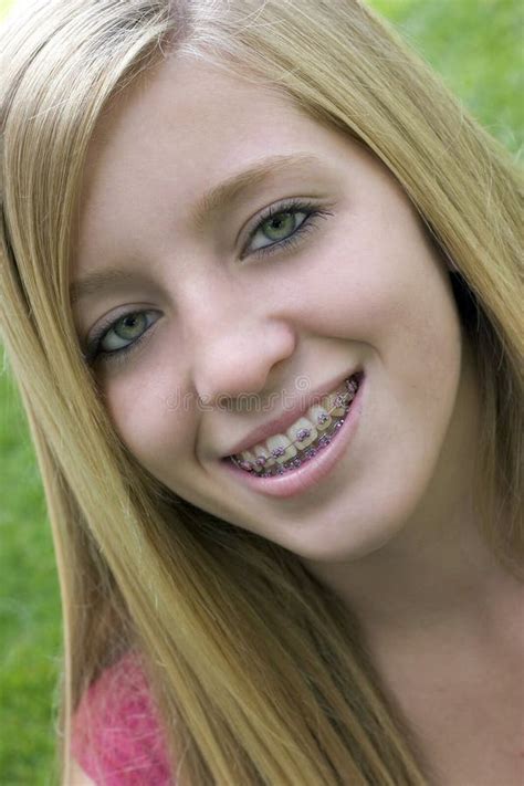 Blonde Girl Braces Stock Photos Free Royalty Free Stock Photos From Dreamstime
