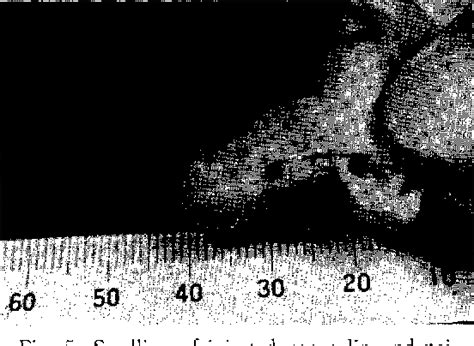 Figure From The Nude Mouse As An Experimental Lepromatous Leprosy Model Continued The NFS N