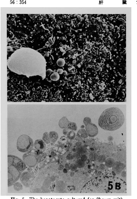 Figure From The Cytotoxicity Of Chenodeoxycholic Acid Cdca And