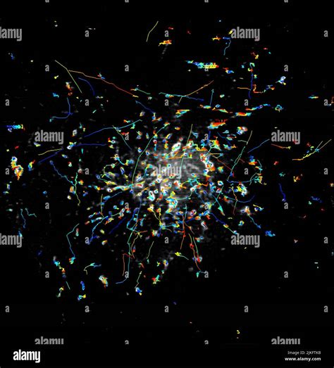 Microscope human cell images hi-res stock photography and images - Alamy