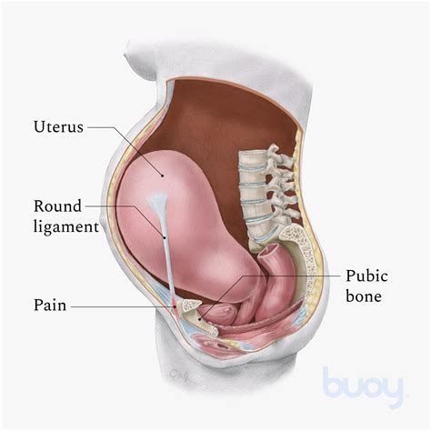 Ligamento redondo | Guía de salud | Vidaliax