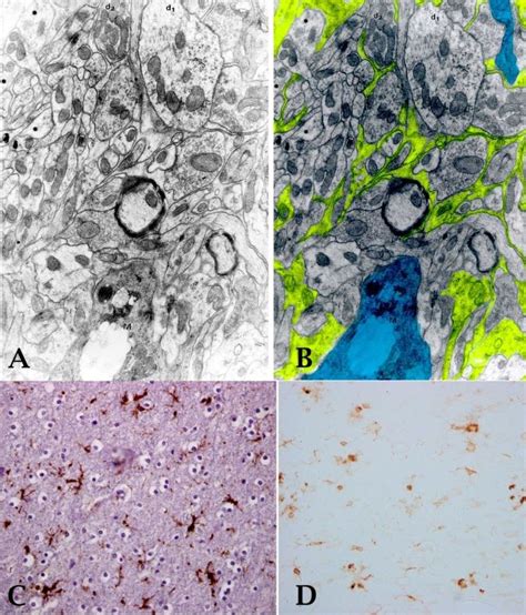 Hypertrophic Microglia A Electron Microscopy Image Of A Round