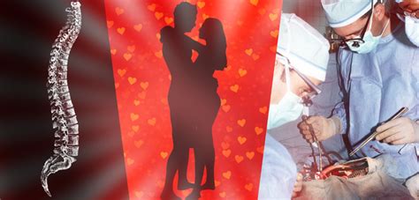 Spine Sex And Surgery Orthopedics This Week