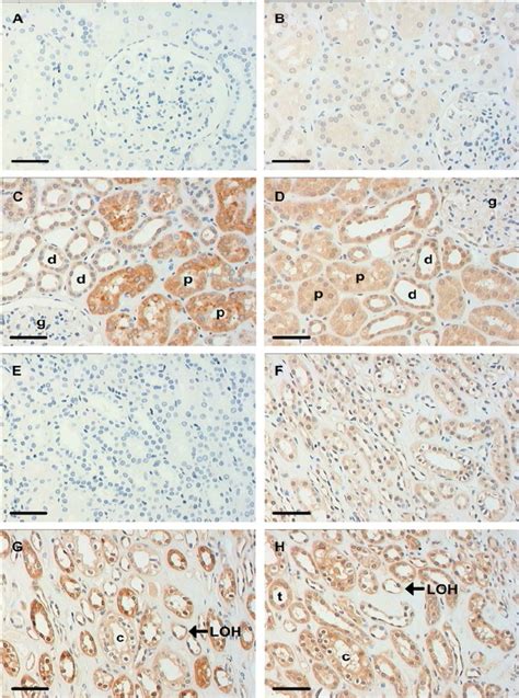 Immunohistochemistry Of Human Kidney Cortex And Medulla Human Kidney