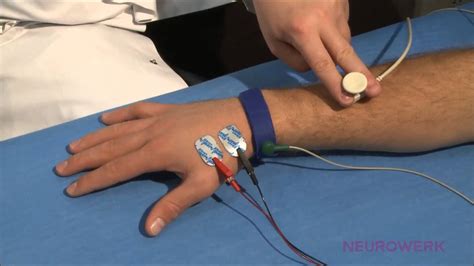 Radial Motor Nerve Conduction Study