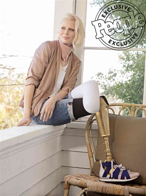 Toxic Shock Syndrome Survivor Lauren Wasser Posts Update One Year Since