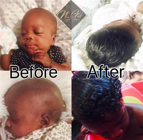 Newborn Hair Growth - Etsy