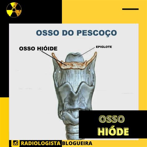 Osso HiÓde